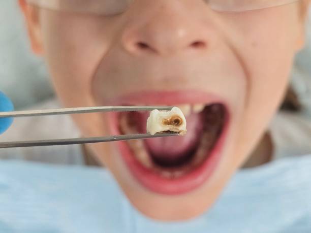 Best Pediatric Emergency Dentist in Corrales, NM